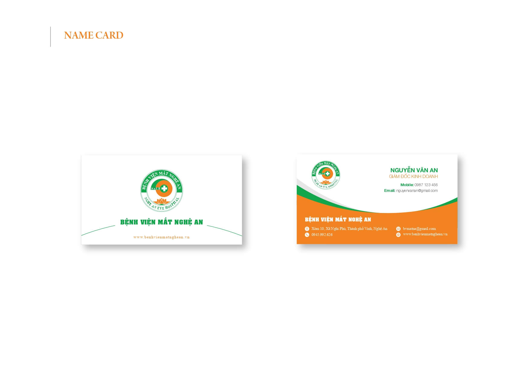 Thiết kế Name Card Bệnh Viện Mắt Nghệ An - do đội ngũ Thiết kế F99 Logo thực hiện